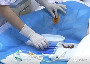女性导尿在线视频看看吧,实用教程与注意事项